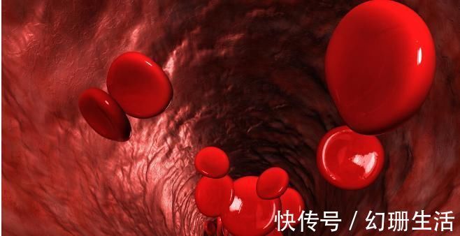 肖老师|45岁男子突发糖尿病离世,医生:一种调料吃太多,血糖升得快