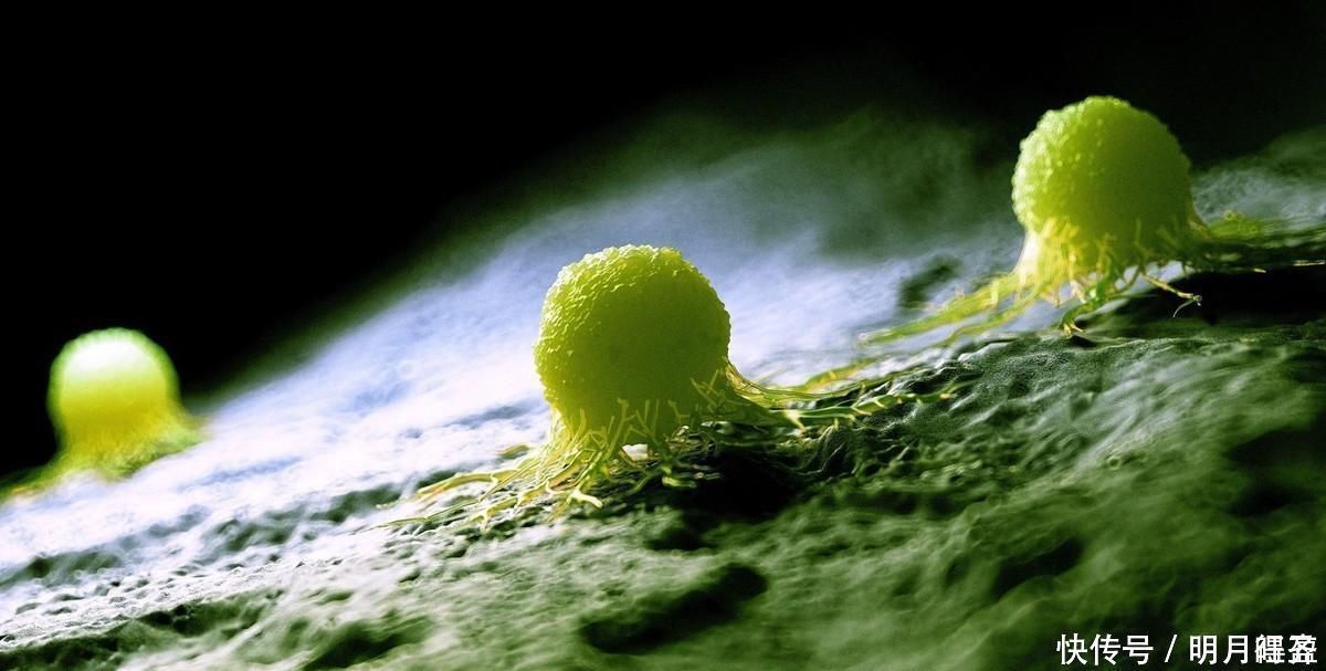 临床研究|提醒身体长出这3种息肉,一定要及时切掉,尤其第二种,拖不得