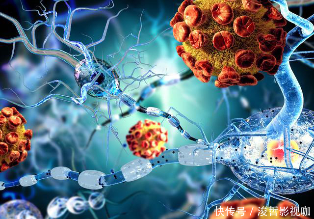 细胞|明明是早期肺癌，根治手术之后一个月发生骨转移，到底是什么原因