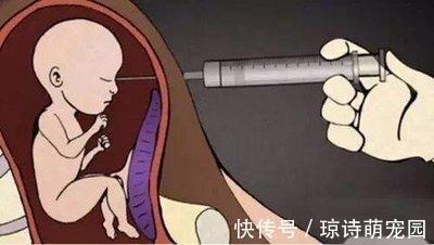 胎儿|孕妇被迫引产,腹中胎儿有感觉吗?看完这些画面,后悔得掩面痛哭