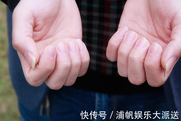 打针|身体健不健康,看手上青筋就知晓,可惜不少人还被“闷”在鼓子里