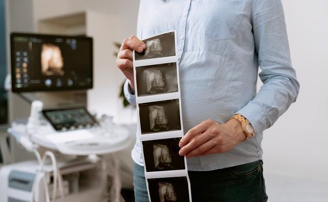 大排畸|大排畸能查出所有的胎儿畸形吗？一次通过大排畸的经验分享给大家