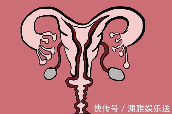 黄褐斑|子宫不太好的女性,脸上或会出现四种表现,若都没有,子宫很健康