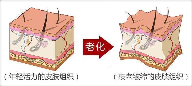 拉皮手术 为什么拉皮手术成为了很多人的选择？