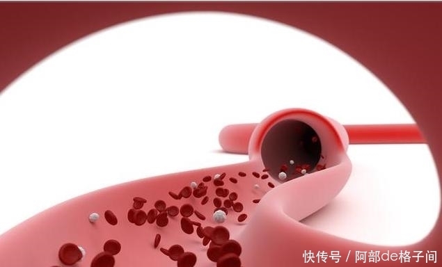 脑血管|2件小事坚持做，血脂会心甘情愿降下去，不给你添乱