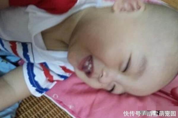 孩子睡觉总是咧着嘴笑，父母带娃去医院检查，医生：幸亏来得及时