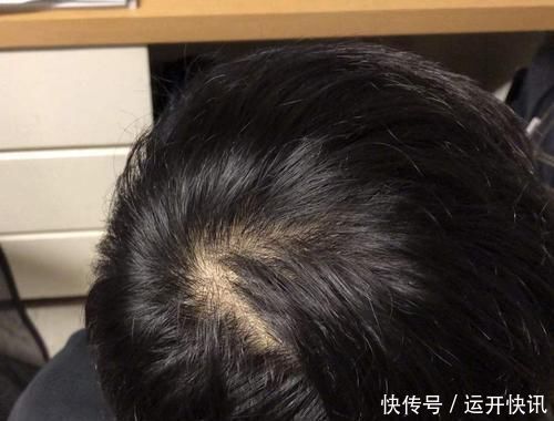 男人|男人身体若出现4个迹象，或是在提醒：雄性激素快要“干涸”了