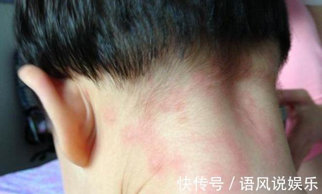 床铺|孩子哭着说身上痒，母亲掀开床垫清理，结果发现一物想要呕吐