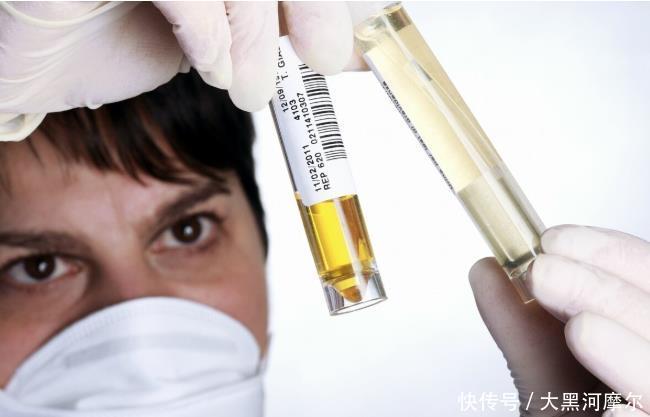 肾病|肾病不可只看尿蛋白不想耽误病情,有4项指标最好快点弄清楚