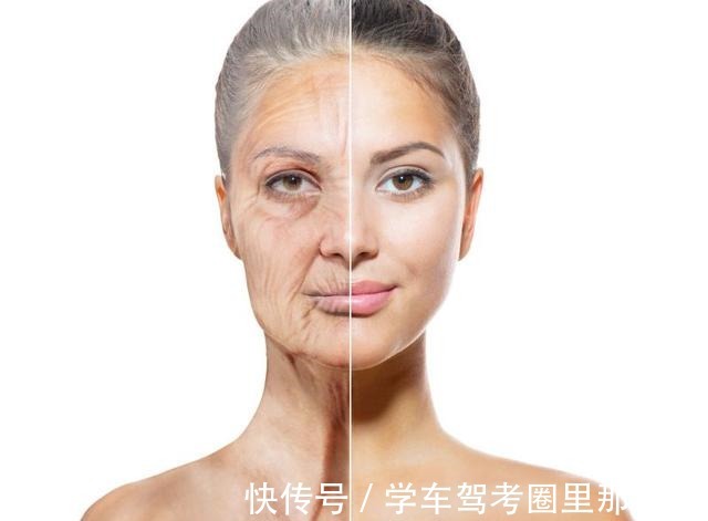 法令纹 32岁姑娘小拉皮术后7个半月,变得年轻又精致,前后反差很大!