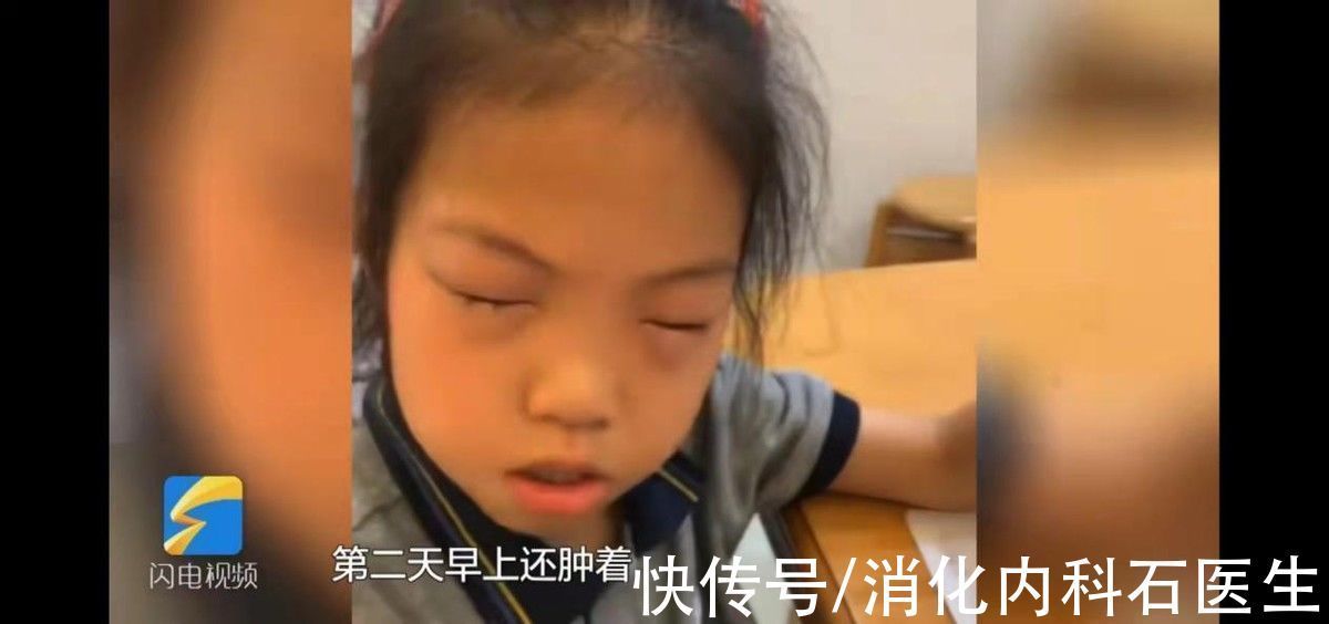 心理因素|有一种过敏,叫“数学过敏”,你家那位孩子,“数学”了吗?