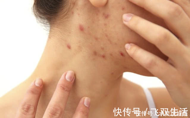 肝毒|脸上有3个信号,说明肝毒太多,4个简单方法可养好肝脏