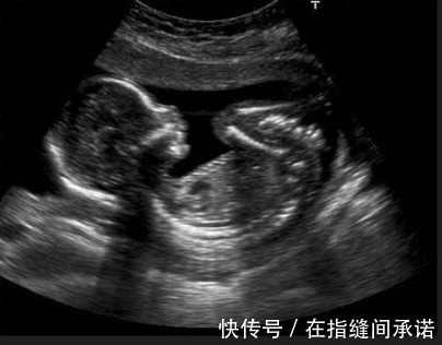 小家伙|孕期孕妈如果有这三种表现,恭喜你胎儿智力发育很好