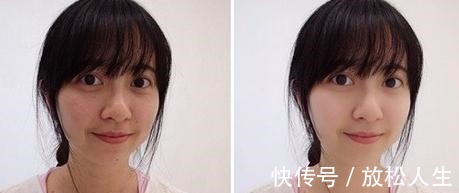 老年斑|药店有种“不起眼”的祛斑霜,雀斑老年斑都清除,美白祛斑还嫩肤!