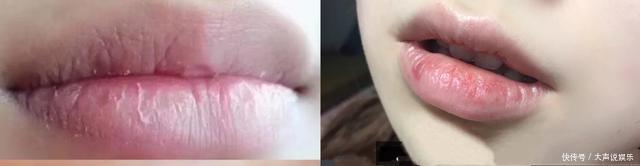 唇部出现这个问题,口红再贵也白搭,拉低颜值还影响形象