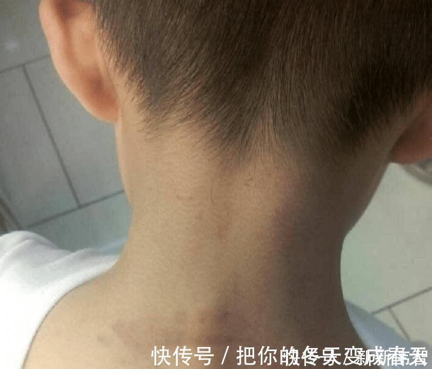 掌掴|“你凭什么还手?”儿子受欺负还手反被惩罚,宝妈气不过掌掴老师