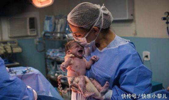 巴西“臭脸”宝宝走红，怒瞪医生引大笑，网友：表情包出炉