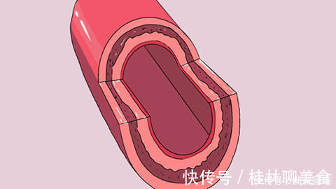 高血脂|花生的营养被低估?每天吃多少花生,能起到养生效果?有答案了