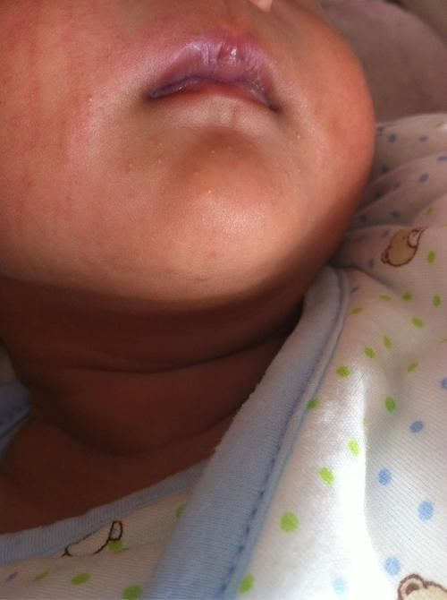 逆袭|90后宝妈生下“小包公”,全家人都嫌丑,两个月后逆袭成“团宠”