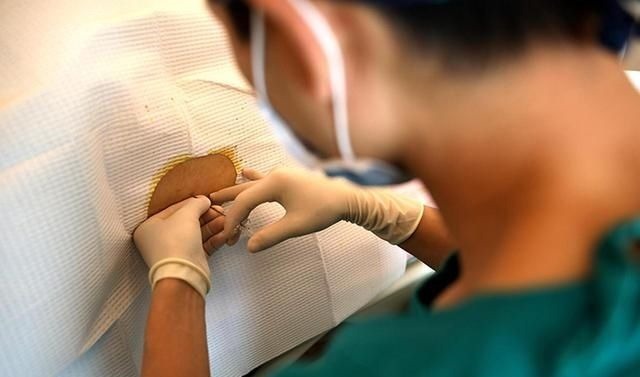 顺产|宝妈吐槽分娩时的尴尬:头胎顺产被“剃毛”,二胎剖腹产也没逃掉