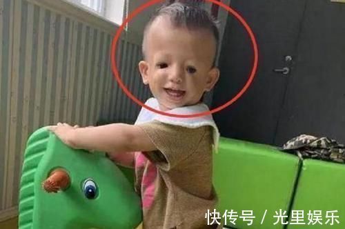 反对|“鸟脸妈妈”生孩子遭家人反对,宝宝出生后,妈妈十分后悔