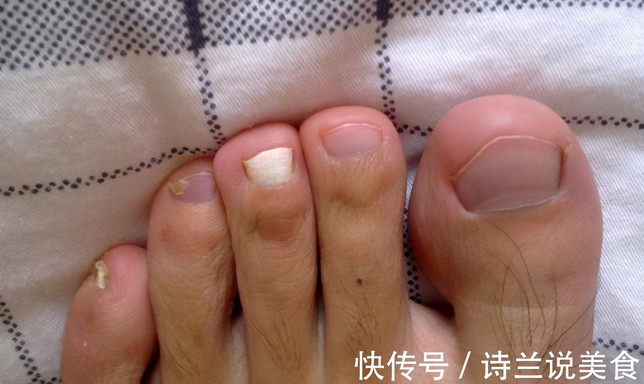 黄麦|脚是身体的“放大镜”,出现3种情况,可能是健康发出“预警”!