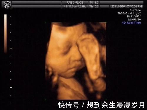 面部|做四维医生说腹部脂肪厚,看不清,打出来单子也只能看宝宝大概面部怎么办?