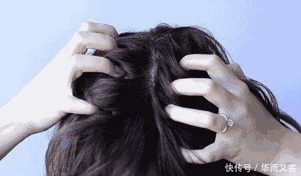 头上有这“3个表现”，很可能是有螨虫“做窝”，尽早处理一下