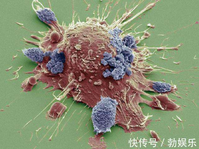 蕨菜素|肿瘤主任癌症晚期，常吃3种蔬菜，或让你多活10年！