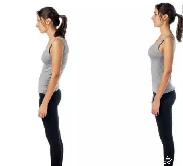 驼背|驼背也可能驼出大宽胯，6个动作改善驼背，回归挺拔身姿
