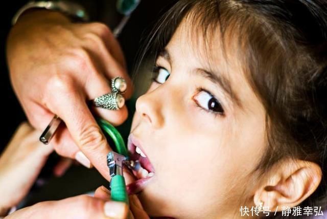 吃糖|10个5岁儿童中，7个有龋齿，罪魁祸首居然不是糖？