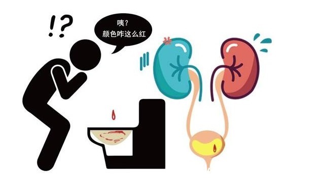尿液|夜里小便次数多危害大?泌尿科医生:小便出现4种异常才最关键