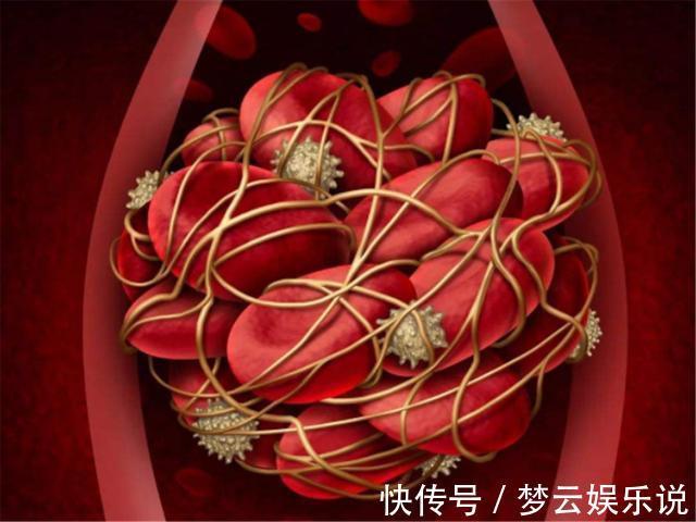 健康|脑供血不足的人,牢记多喝2水,做好2件事,养护血管健康