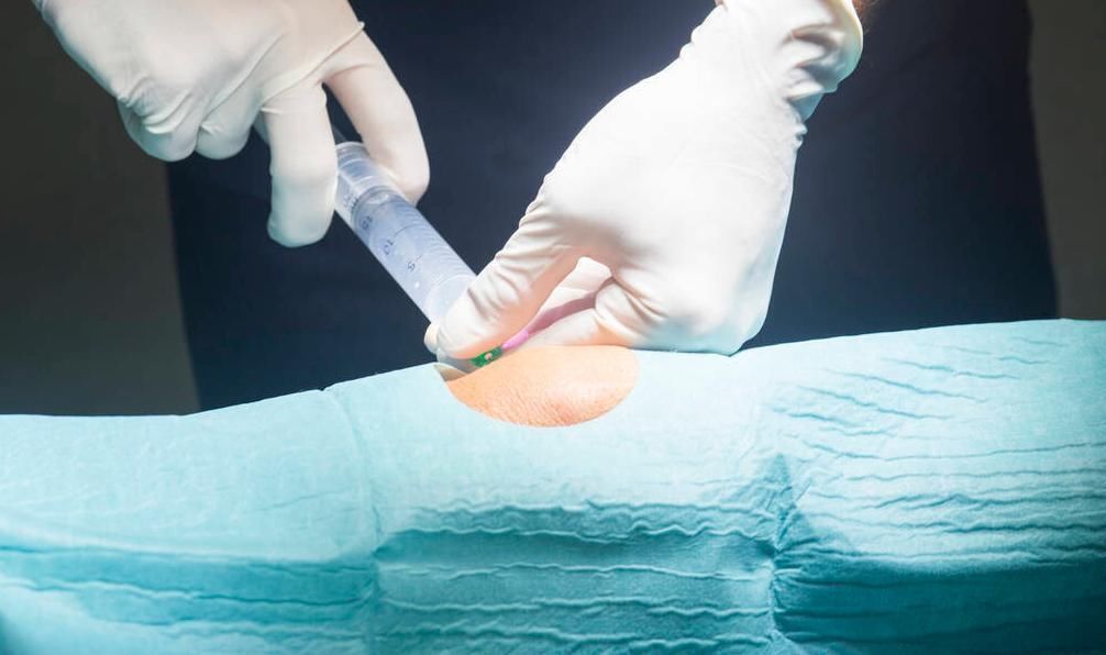 体力劳动|骨科主任:开水里放1勺,连喝30天,膝盖不痛,关节积液也没了