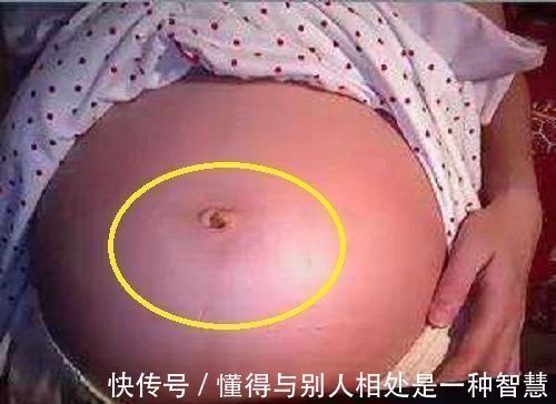 有福气|孕妈的肚脐,凸出来好还是凹进去好如果是这种状况说明很有福气