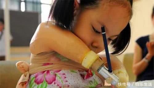 孩子|孕检发现孩子没有手脚,妈妈却坚持和医生说“生”,如今活成公主
