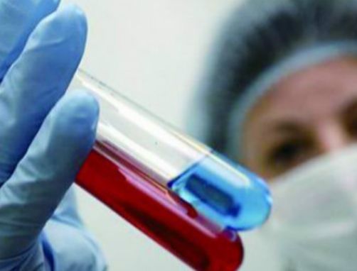 癌症|无论男女，身上若无2个“凸起”，恭喜！“癌细胞”还没有缠上你