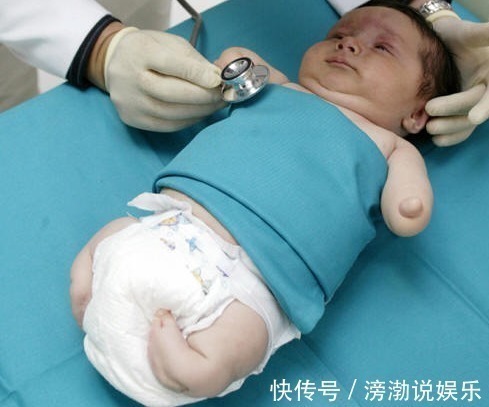 怀孕|怀孕20周,四维彩超却发现胎儿畸形,闻到孕妇身上的味道明白了