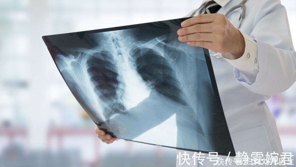 并发症|癌细胞是如何“杀死”一个人的?它喜欢你做这3件事,别给它机会