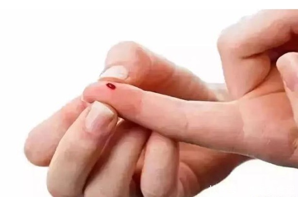 糖尿病人|糖尿病可以活多少年?提醒:睡觉时有4种表现,抓紧查一查血糖