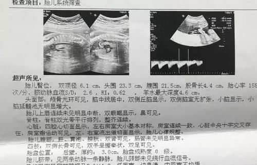 孕妇排畸检查，做三维彩超好还是四维彩超好？看完就不会纠结了