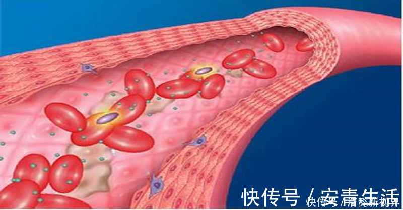 吸收率|老年人每天一颗鸡蛋,对动脉粥样硬化的发生影响有多大?