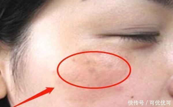 黑色素|女人30岁后怎么保养自己？这样做，越活越年轻！