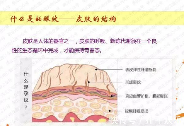 肚子|两闺蜜同时怀孕,掀开衣服看到肚子时,对比太扎心了