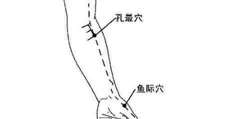  淤堵|14经脉中，这几个穴位最容易淤堵！