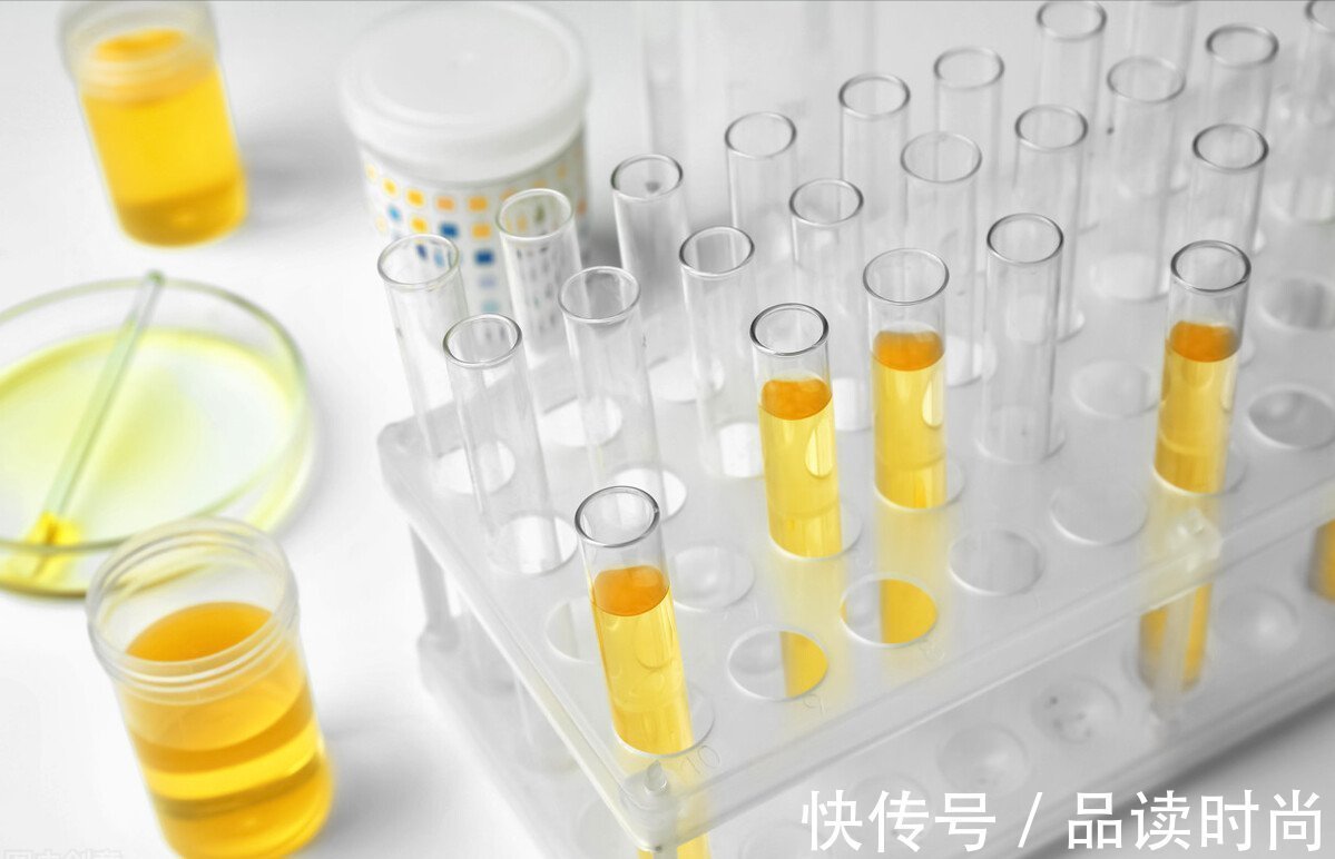 糖尿病肾病|3个中成药,多靶点改善糖尿病微血管病变,减少尿蛋白保护肾功能