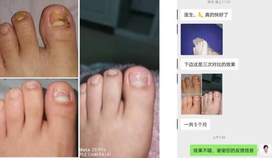 后果|全民护肤日：这些后果严重的皮肤病，却常常被忽视