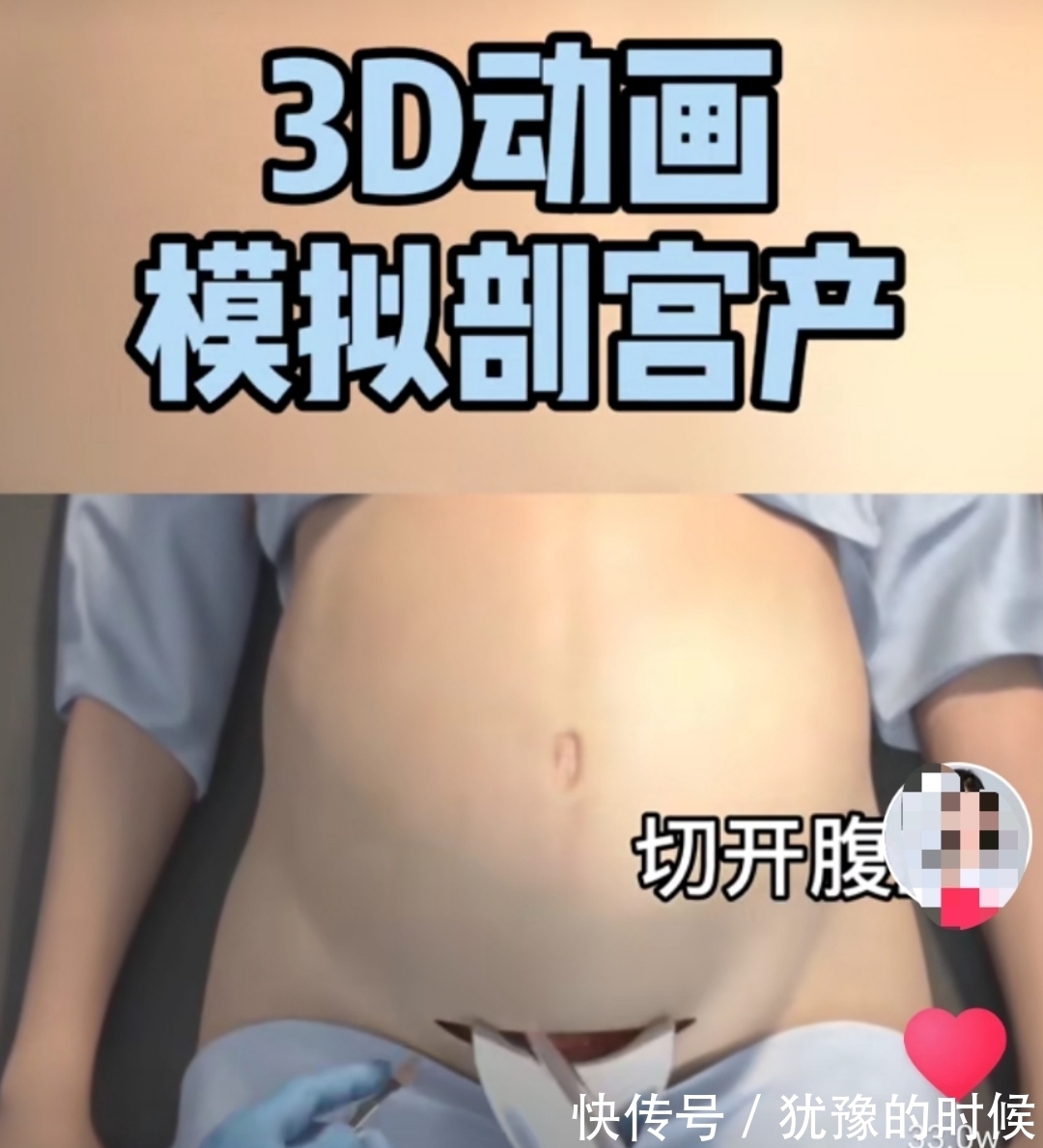 顺产|剖宫产有多“伤”妈妈,几张3D过程图带你了解,感恩老婆和妈妈