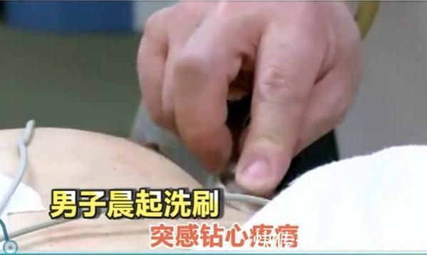 疾病|它是目前死亡率最高的疾病,发病没有任何征兆!连医生都怕它