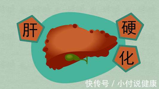 中老年人|肝硬化怎么来的？肝病医生：都是睡前这四个习惯害的